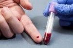 Phát hiện 5 loại ung thư chỉ bằng một giọt máu