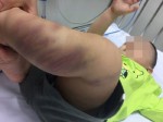 Bé trai hơn 1 tuổi bị bạo hành, bỏ ở bệnh viện: Lộ diện người bỏ rơi