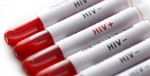 phat-hien-nhom-hop-chat-co-the-pha-vo-cac-phan-tu-virus-hiv-aids