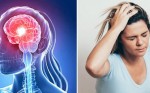 8 kiểu đau đầu là do bệnh nguy hiểm, liên quan đến mạch máu não không thể chủ quan