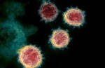 virus-sars-cov-2-dot-bien-32-lan-trong-nguoi-benh-nhan-hiv