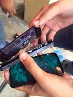 iPhone phát nổ trong túi quần vì nắng nóng, nam thanh niên bị bỏng nặng