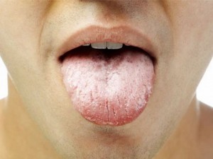 Màu của lưỡi cảnh báo bệnh gì?