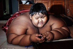 Bé trai béo nhất thế giới, 10 tuổi nặng gần 2 tạ