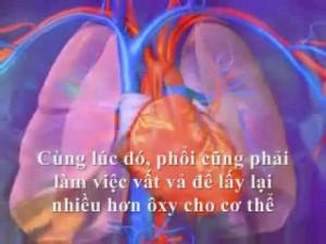 5 đối tượng nên đi sàng lọc bệnh tăng áp động mạch phổi