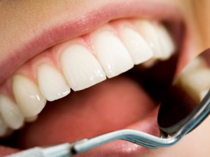 3 phút hết sạch cao răng với 1 quả chanh không cần đi nha sỹ