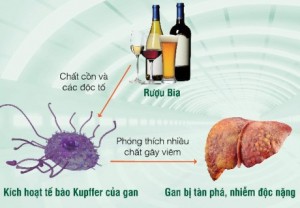 Thủ phạm gây ung thư gan hàng đầu mà người Việt thường xuyên mắc phải