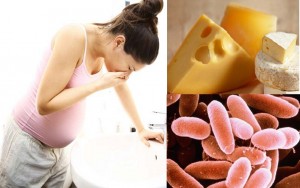 Ăn phô mai nhiễm khuẩn Listeria ảnh hưởng nghiêm trọng tới thai nhi