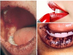 Nữ MC ngộ độc chì vì thói quen tô son môi đậm