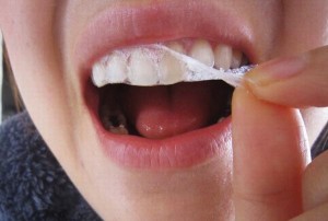 Sử dụng miếng dán làm trắng răng có thật sự tốt - Những điều chị em không thể không biết