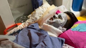 Việt kiều bị tạt axit, cắt gân chân: Thu giữ nhiều chứng cứ quan trọng