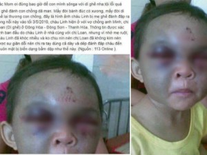 Thực hư thông tin bé trai ở Thanh Hóa bị dì ghẻ đánh đập thâm tím mặt vì… nhớ mẹ