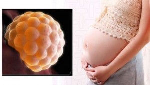 Từ vụ cô gái 20 tuổi bị chửa trứng: Những dấu hiệu đặc biệt quan trọng chị em cần lưu ý để phát hiện sớm tình trạng bất thường thai nghén này