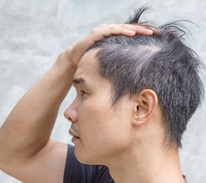 3 cách trị tóc bạc, rụng tóc dễ mua, dễ làm lại hiệu quả cho người trẻ tuổi