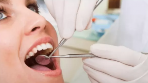 Nguy cơ 'gặp họa' khi sử dụng thuốc tẩy trắng răng