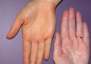 Bàn tay có thể nói lên tuổi thọ của một người, sống lâu ắt sẽ xuất hiện 6 điểm đặc biệt